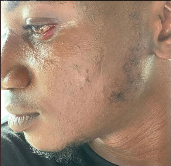 Peruzzi Beat Up Popular Social Media Influencer, The Pamilerin (Dr Pam Pam)